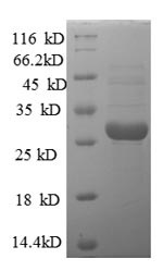 (Tris-Glycine gel) Discontinuous SDS-PAGE (reduced) with 5% enrichment gel and 15% separation gel.