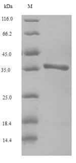 (Tris-Glycine gel) Discontinuous SDS-PAGE (reduced) with 5% enrichment gel and 15% separation gel.