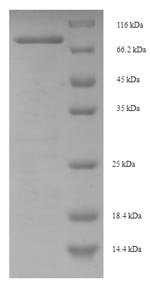 (Tris-Glycine gel) Discontinuous SDS-PAGE (reduced) with 5% enrichment gel and 15% separation gel.