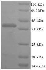 (Tris-Glycine gel) Discontinuous SDS-PAGE (reduced) with 5% enrichment gel and 15% separation gel.