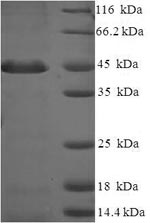 (Tris-Glycine gel) Discontinuous SDS-PAGE (reduced) with 5% enrichment gel and 15% separation gel.