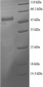 (Tris-Glycine gel) Discontinuous SDS-PAGE (reduced) with 5% enrichment gel and 15% separation gel.