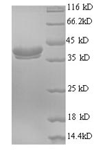 (Tris-Glycine gel) Discontinuous SDS-PAGE (reduced) with 5% enrichment gel and 15% separation gel.