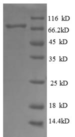 (Tris-Glycine gel) Discontinuous SDS-PAGE (reduced) with 5% enrichment gel and 15% separation gel.