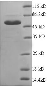 (Tris-Glycine gel) Discontinuous SDS-PAGE (reduced) with 5% enrichment gel and 15% separation gel.