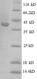 (Tris-Glycine gel) Discontinuous SDS-PAGE (reduced) with 5% enrichment gel and 15% separation gel.