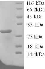 (Tris-Glycine gel) Discontinuous SDS-PAGE (reduced) with 5% enrichment gel and 15% separation gel.