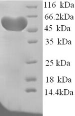 (Tris-Glycine gel) Discontinuous SDS-PAGE (reduced) with 5% enrichment gel and 15% separation gel.