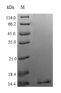 (Tris-Glycine gel) Discontinuous SDS-PAGE (reduced) with 5% enrichment gel and 15% separation gel.