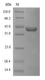 (Tris-Glycine gel) Discontinuous SDS-PAGE (reduced) with 5% enrichment gel and 15% separation gel.