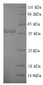 (Tris-Glycine gel) Discontinuous SDS-PAGE (reduced) with 5% enrichment gel and 15% separation gel.