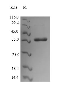 (Tris-Glycine gel) Discontinuous SDS-PAGE (reduced) with 5% enrichment gel and 15% separation gel.