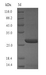 (Tris-Glycine gel) Discontinuous SDS-PAGE (reduced) with 5% enrichment gel and 15% separation gel.